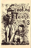 Crooked Teeth #3