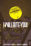 I Will Bite You and Other Stories