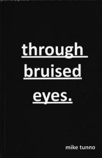 Through Bruised Eyes