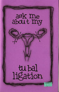 Ask Me About My Tubal Ligation